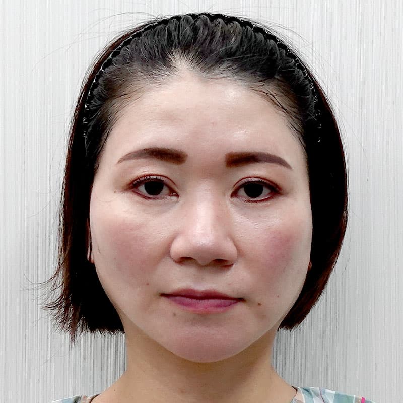 20260527_O18388_sato_face lift①After (1)