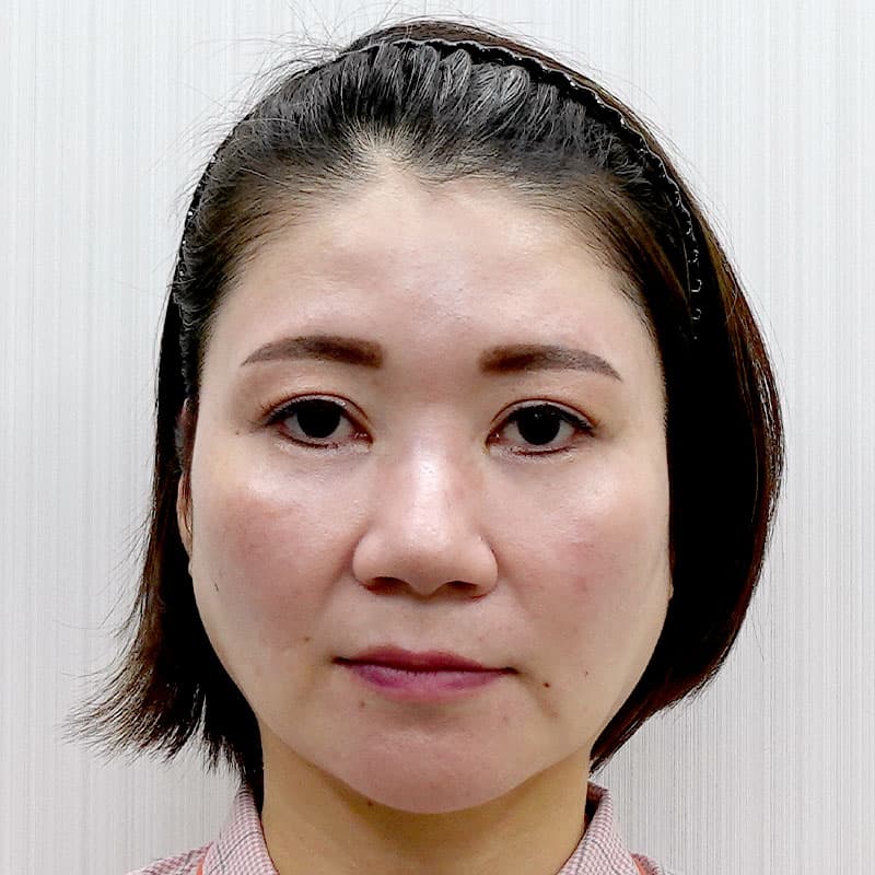 20260527_O18388_sato_face lift①Before