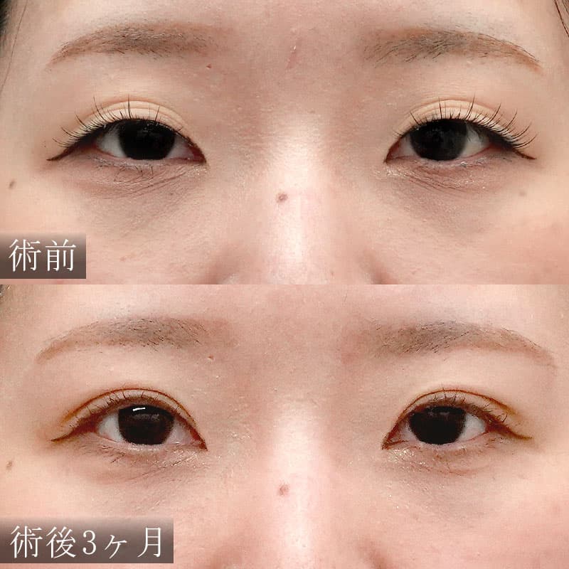 症例