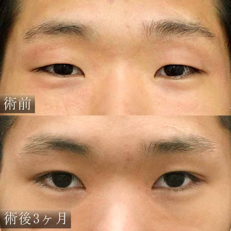 心斎橋院：金子医師執刀