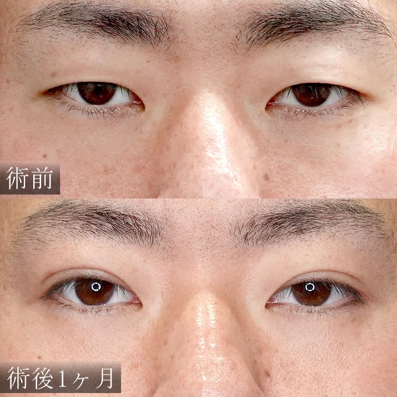 男性症例