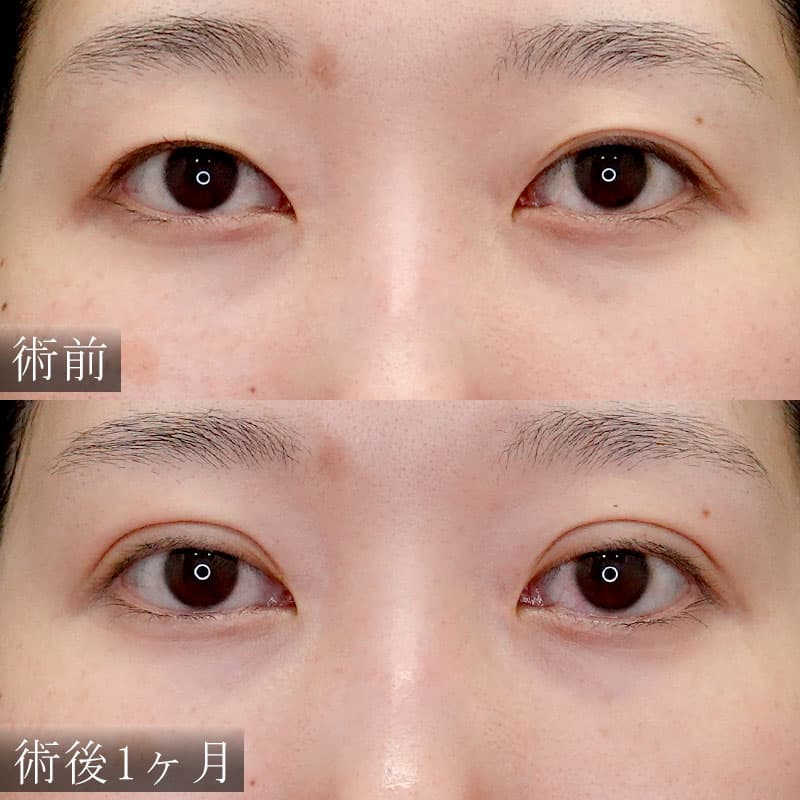 20260707_H179901_sakai_natural adhesion methodメイン横