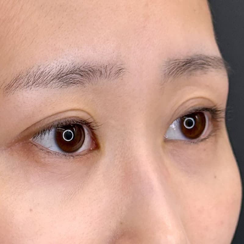 20260714_F1854_kadoya_natural adhesion method①After