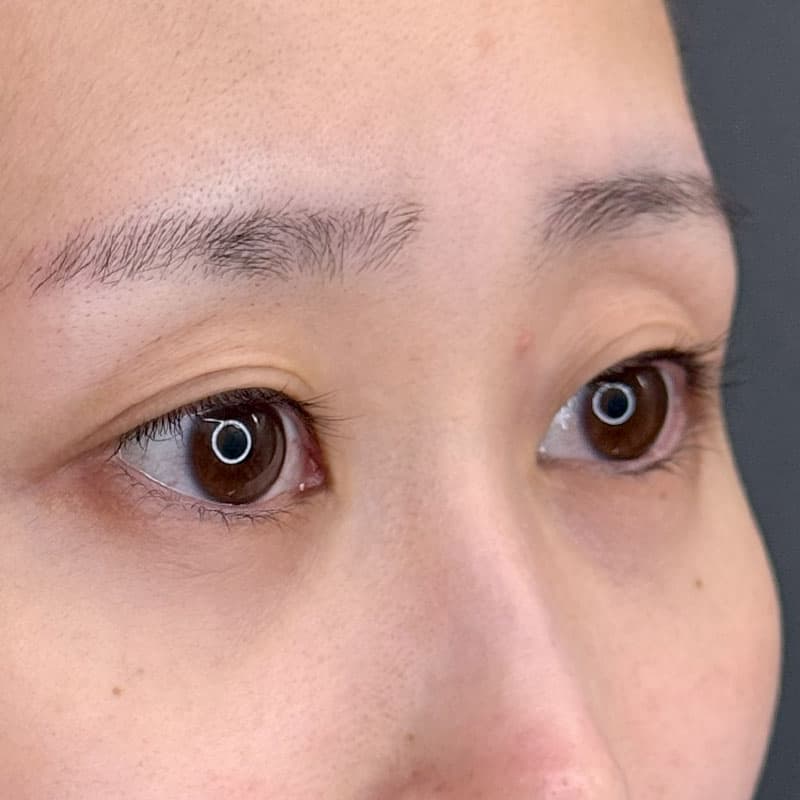20260714_F1854_kadoya_natural adhesion method①Before