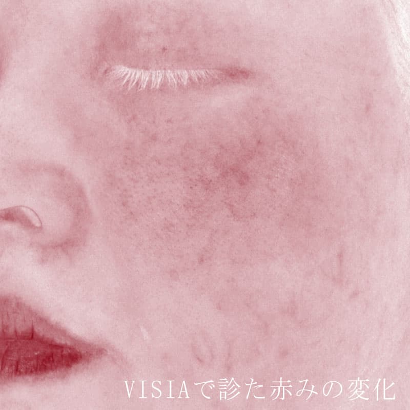 20260727_St20260727-1_blessing①Before
