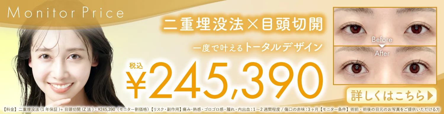 モニタープライス 二重埋没方×目頭切開