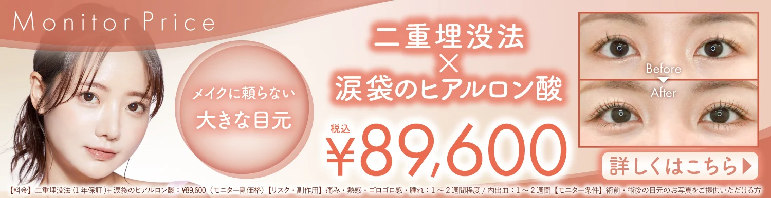 期間限定：二重埋没法×涙袋のヒアルロン酸注入　セット割引